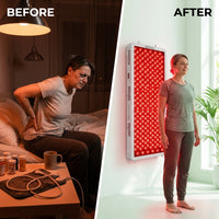 Red Light Therapy Device, 4 Wavelengths Full Body Infrared Red Light Therapy at Home, Elite Grade Dual Chip 300 Leds, High Power, 500W. Modular Design. — Before & After